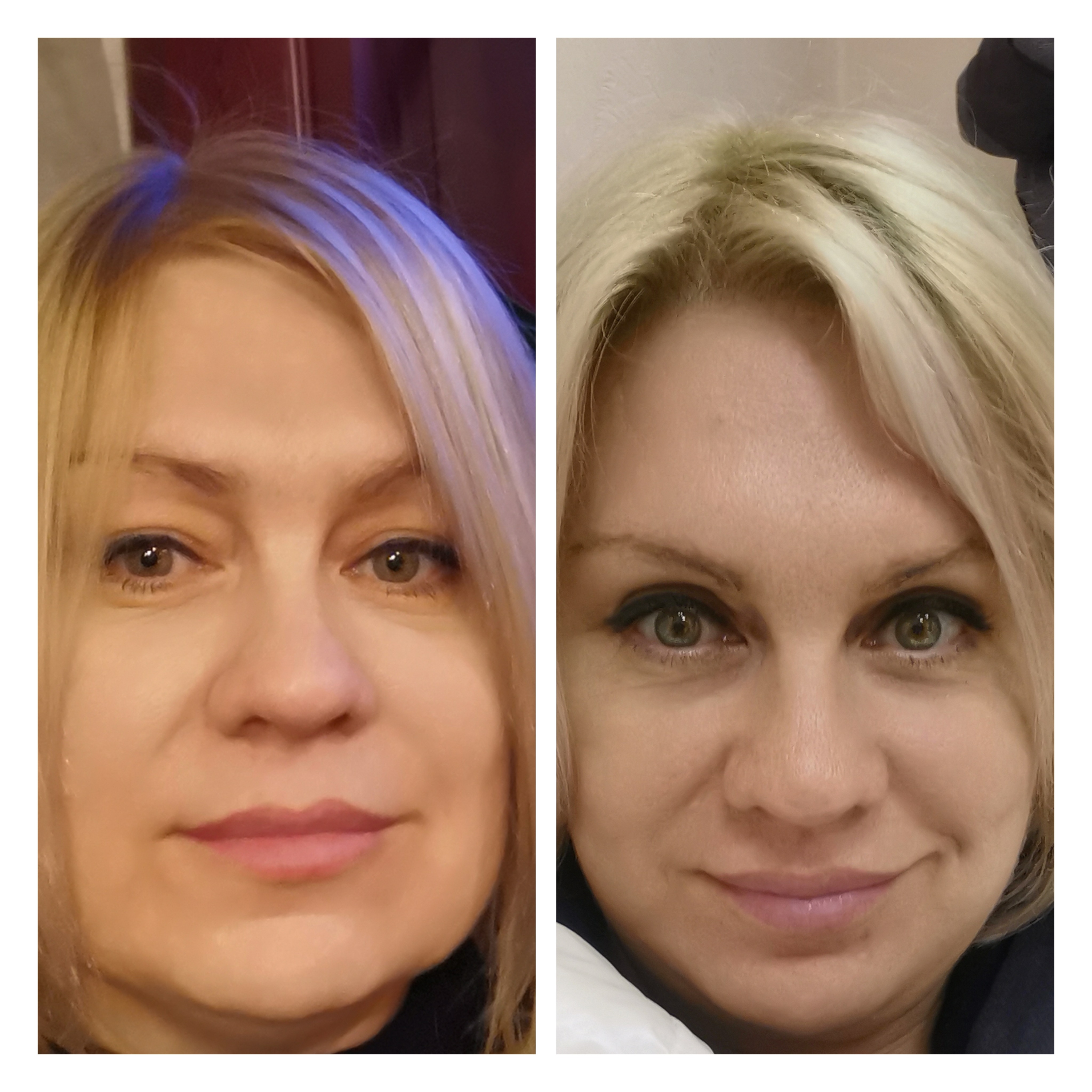 Beauty club, центр эстетической медицины, Шейнкмана, 75, Екатеринбург — 2ГИС