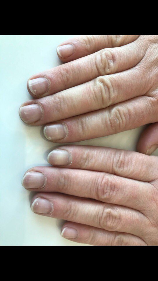 Ногти после 60. Возрастные ногти. Возрастные ногти без покрытия. Возрастной маникюр на короткие ногти. Ногти после 45 лет.