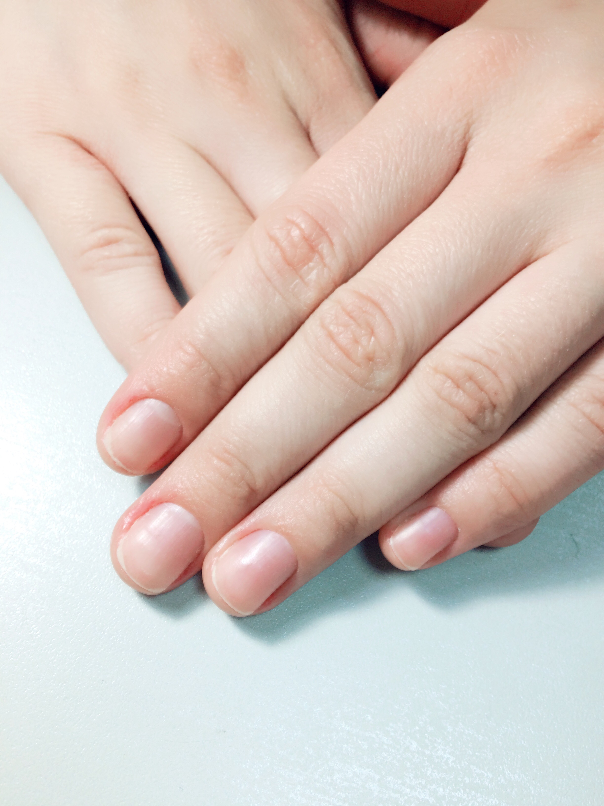 Красивая форма руки. Ногти без маникюра. Натуральные ногти без лака. Женские ногти без лака. Маникюр без покрытия.