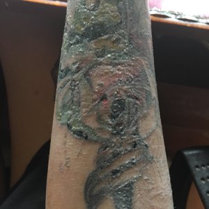Распространенность реакций на татуировки - Ева Арт