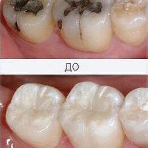 Чем может быть вызвано посинение десны